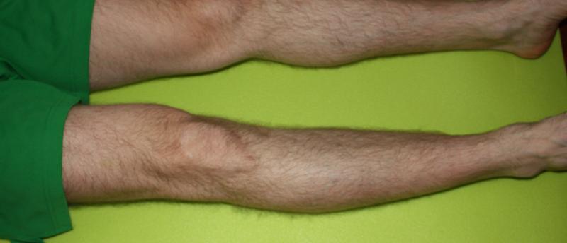 Izometria i siła mięśniowa