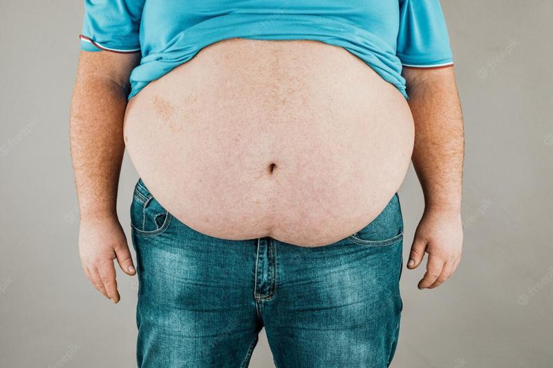 Nadwaga a otyłość