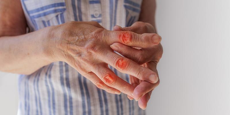 Zapalenie stawów dieta