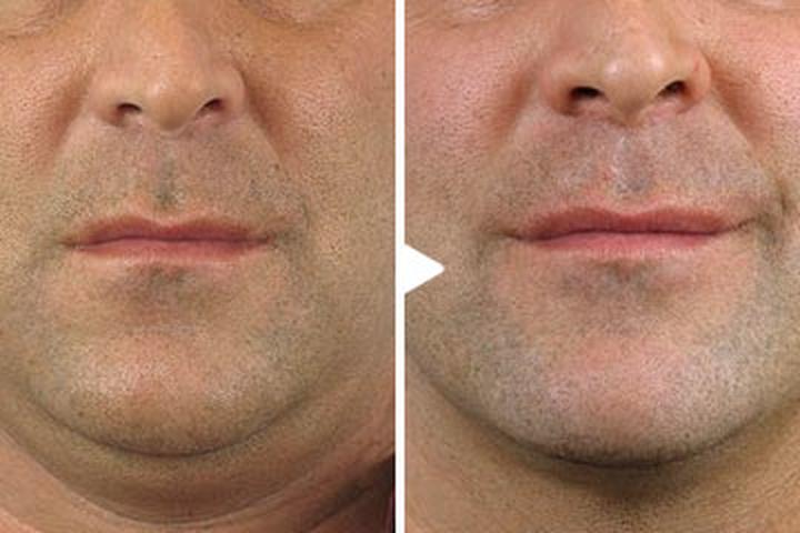 Ćwiczenia i masaże twarzy