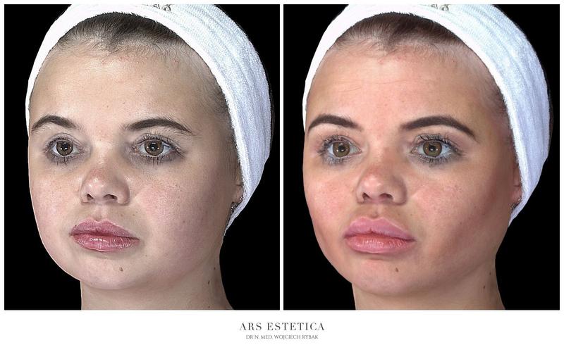 Psychologia i motywacja odchudzania