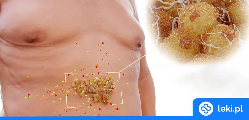 Tłuszcz trzewny a zdrowie