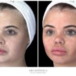 Skuteczne sposoby na to, jak schudnąć z twarzy i wyglądać atrakcyjniej